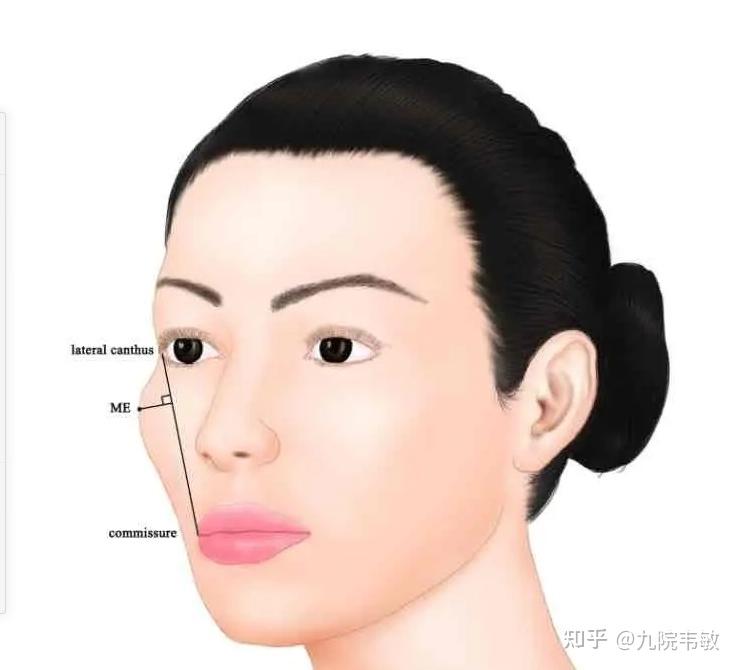九院韦敏说,颧弓颧骨内推能让脸小多少? - 知乎