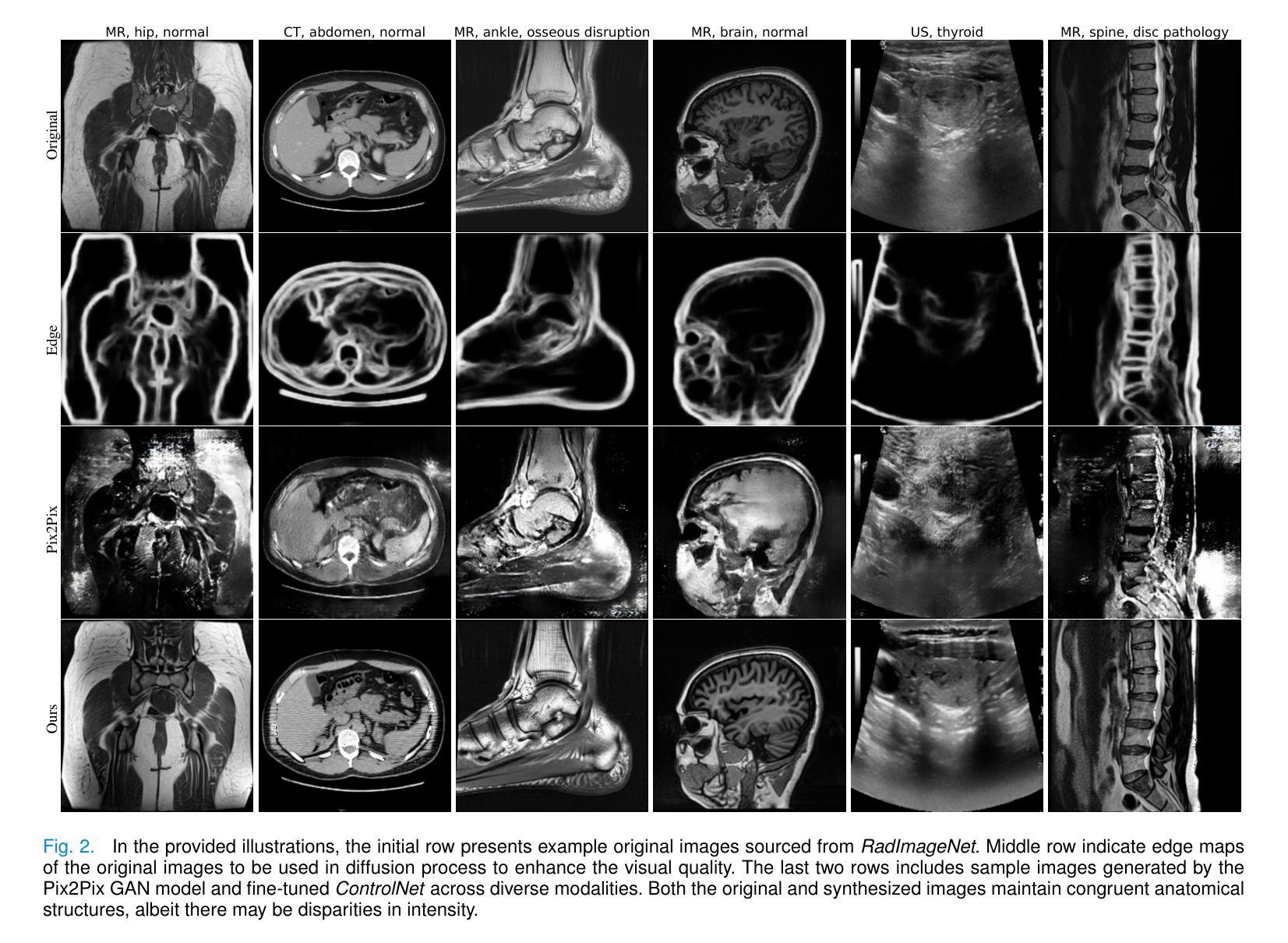 医学影像/Breast Ultrasound