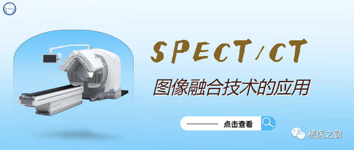 SPECT/CT图像融合技术的应用 - 知乎