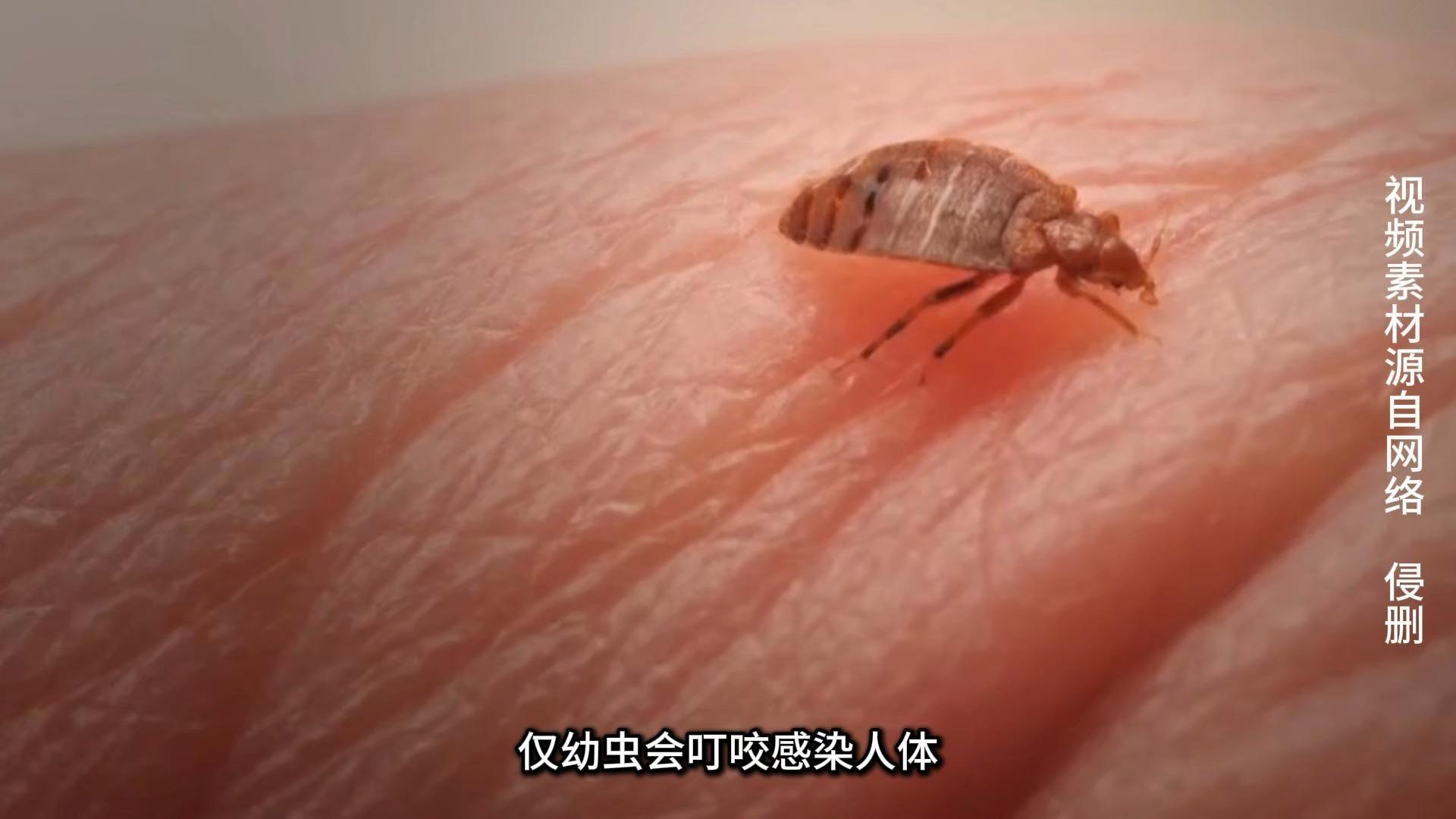 恙虫病严重时可危及生命!如何预防恙虫叮咬?