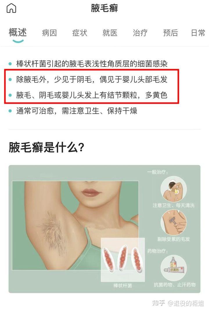 腋下出汗有异味正常吗?