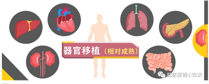 器官移植科普 - 知乎