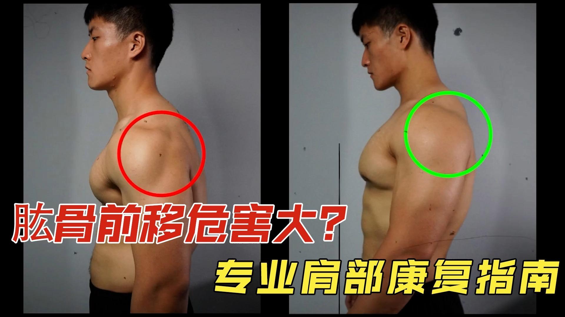 肱骨前移如何调整，需要多久？ - 知乎