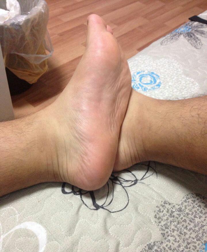 长期赤脚生活的脚底是什么样子的