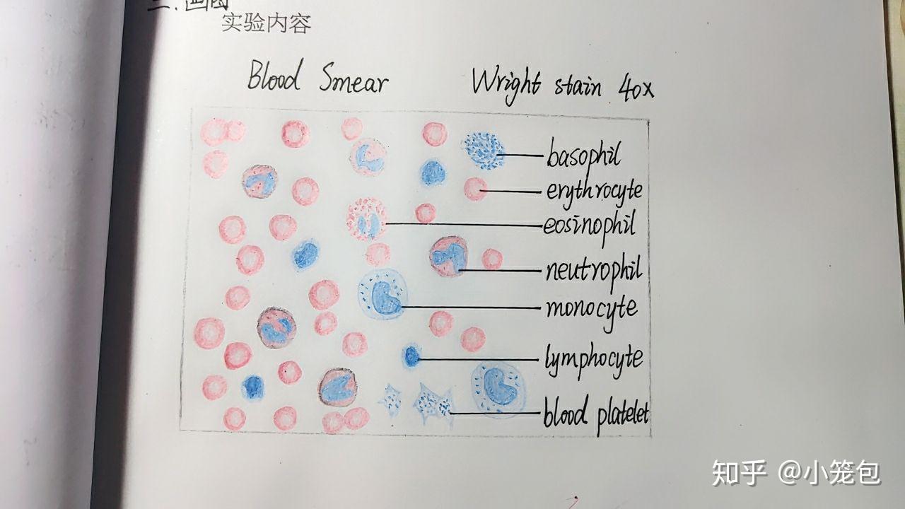 血涂片手绘图淋巴细胞图片
