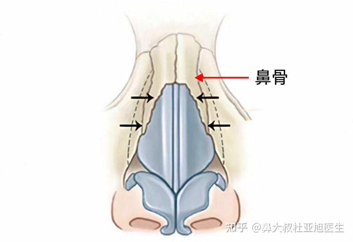 鼻子的骨头结构图片