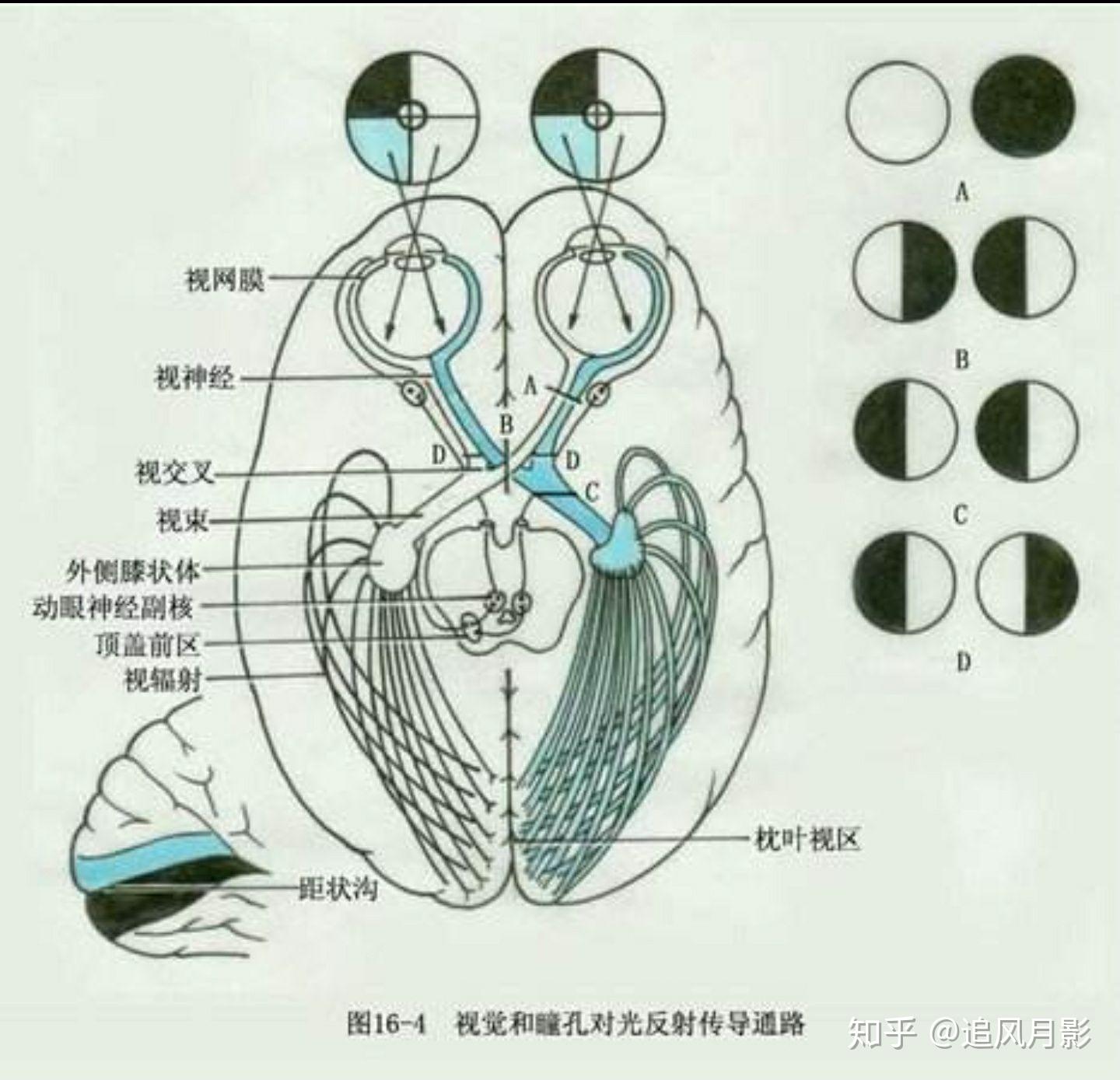 同侧偏盲图片