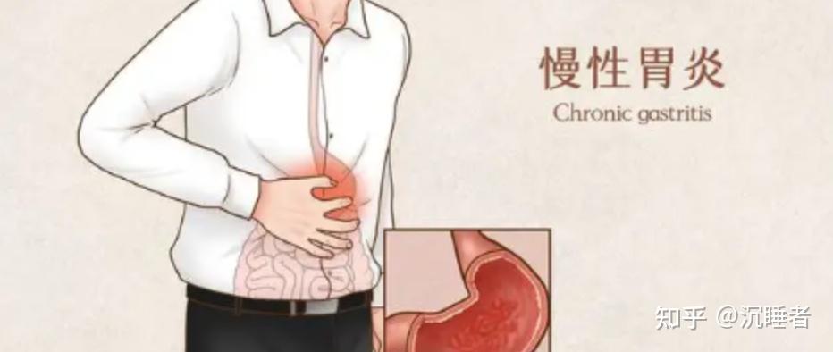胃炎为什么不能自愈? - 知乎
