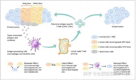 SFRT 空间分割放疗:生物学效应、技术差异、临床现状与未来 - 知乎
