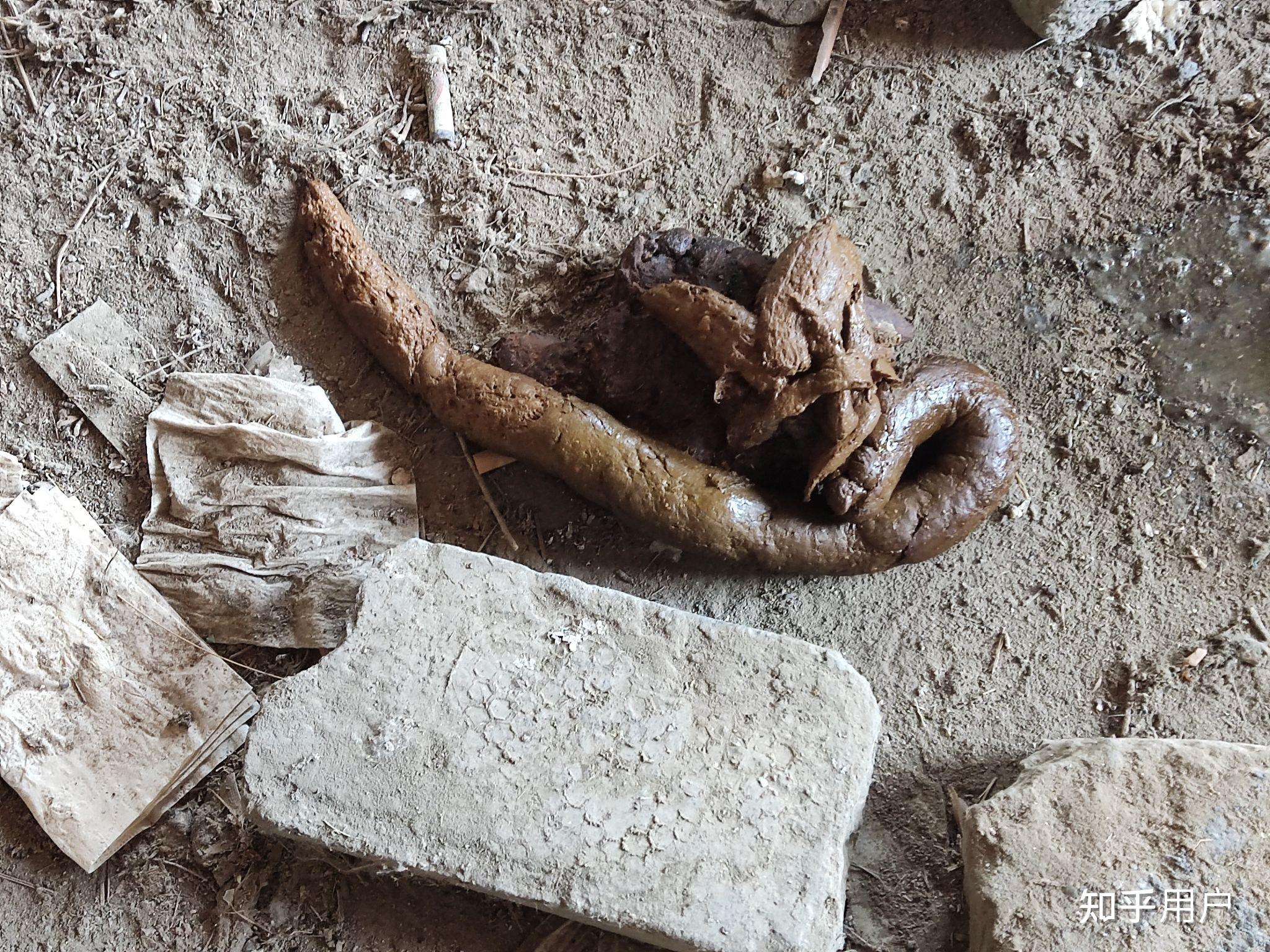 你们见过最大的屎是什么样的