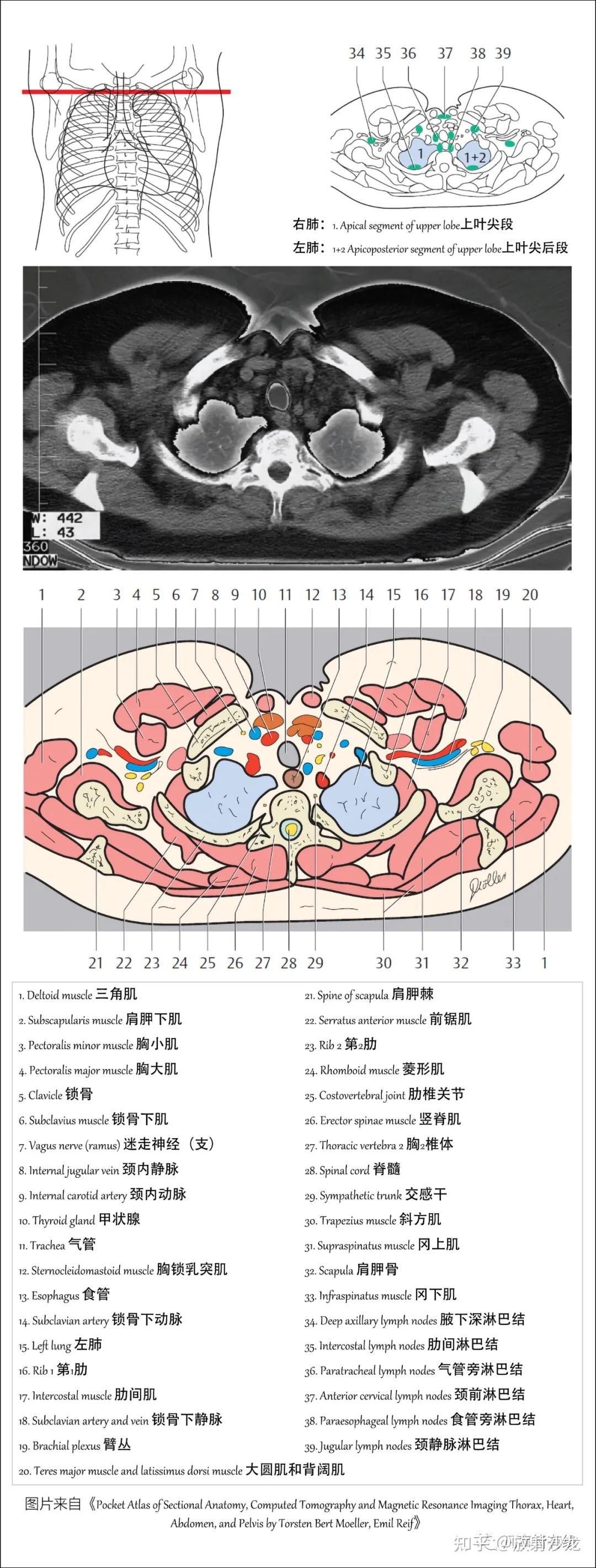 好漂亮的肺部解剖！ - 知乎