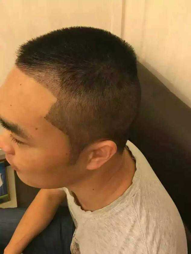 秃额角发际线高适合什么发型