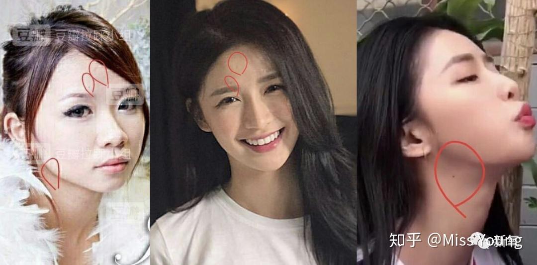 蔡卓宜是整容脸吗?