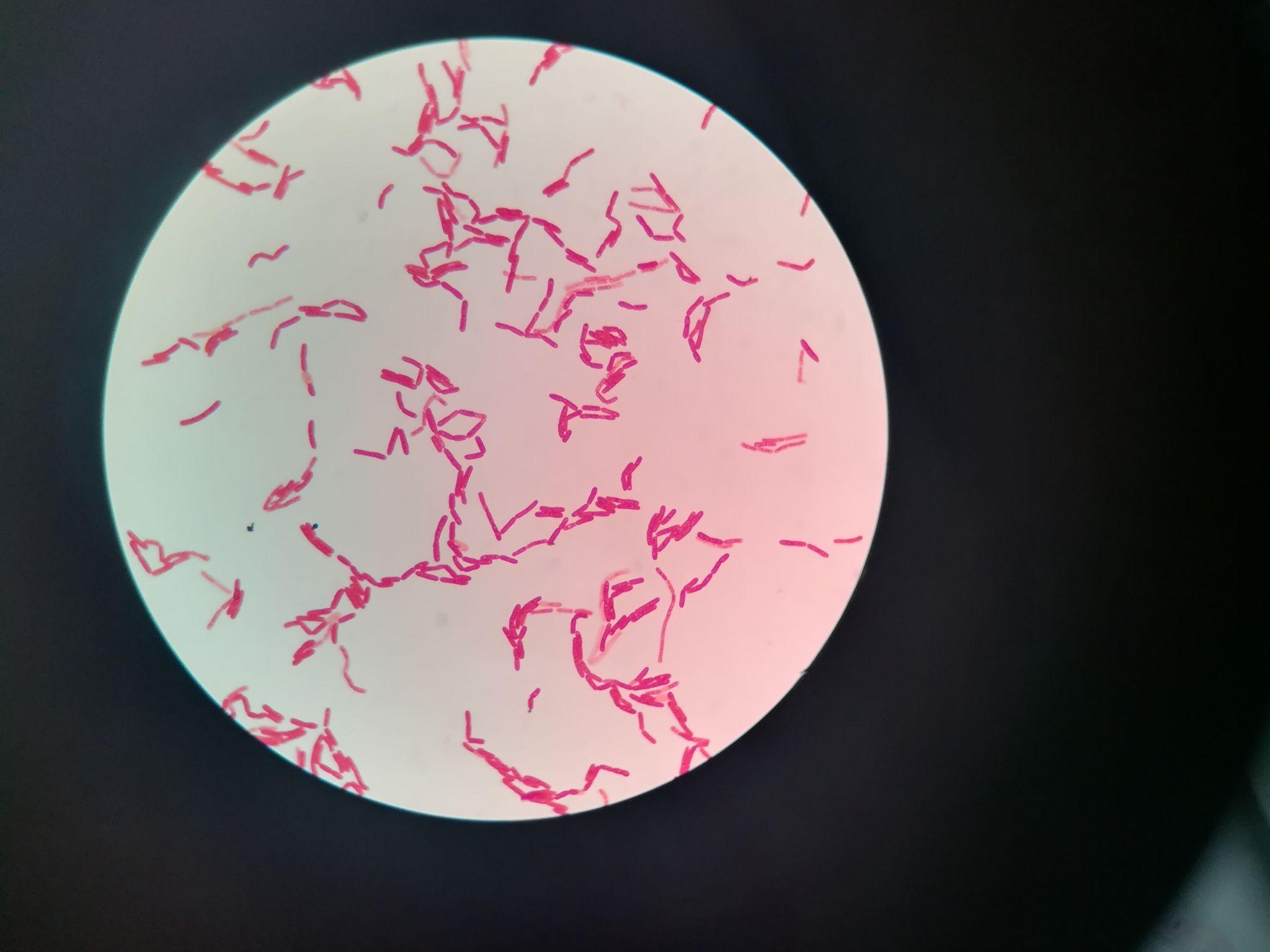 光学显微镜观察血液有何注意事项