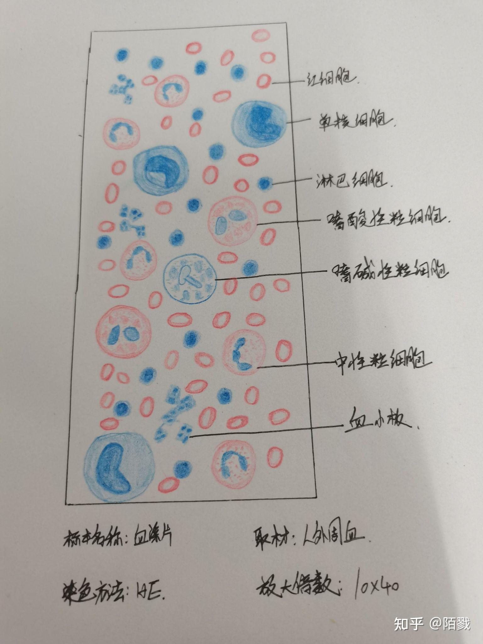 有沒有紅藍鉛筆血塗片的手繪圖