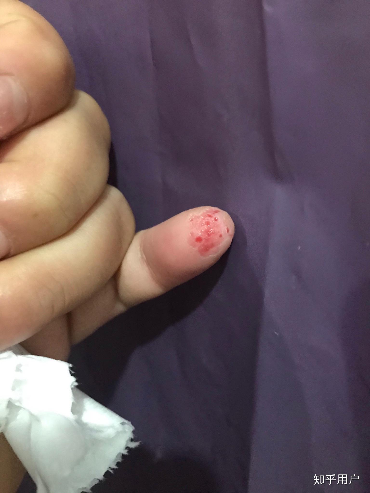 空手指,莲蓬乳是真的吗? - 知乎