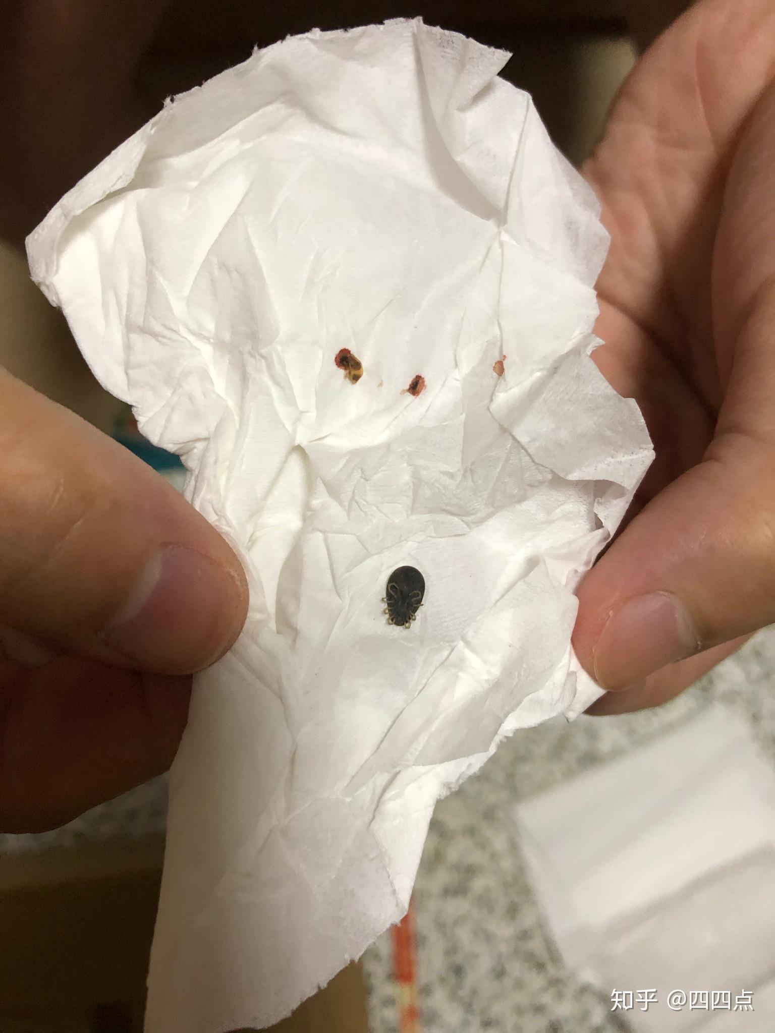 求助这是什么虫子圆圆扁扁的会吸血吗