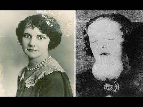 1921年女孩们身体溃烂尸骨发光却被美国公司诬陷为身患梅毒