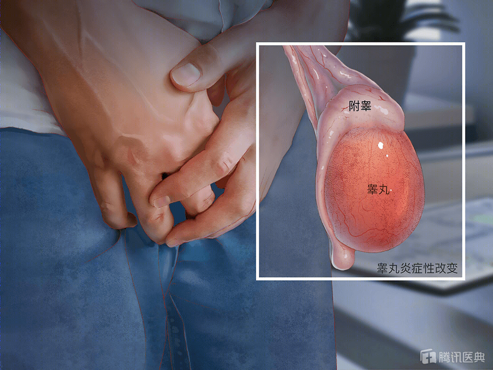 蛋疼是怎么回事