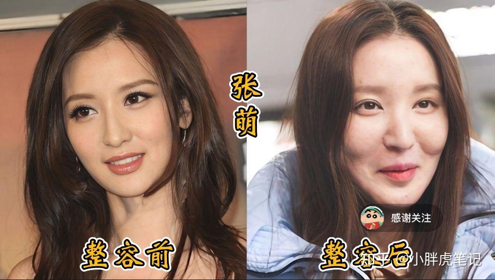 18位女明星整容前后对比，邵音音面目全非，杨颖堪称整容模板！ - 知乎