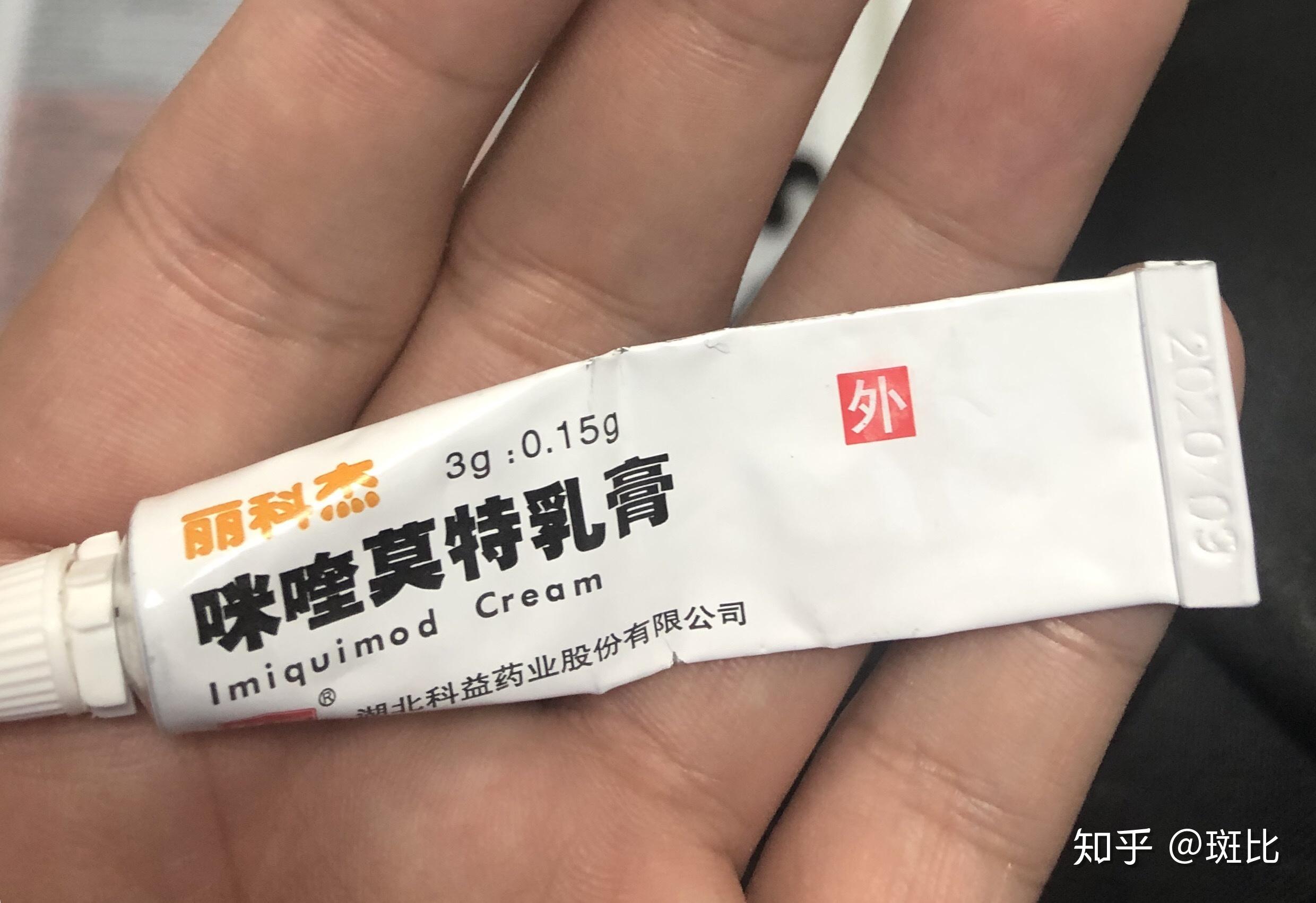 有没有肛内尖锐湿疣治愈的朋友哪种疗法更有效控制复发