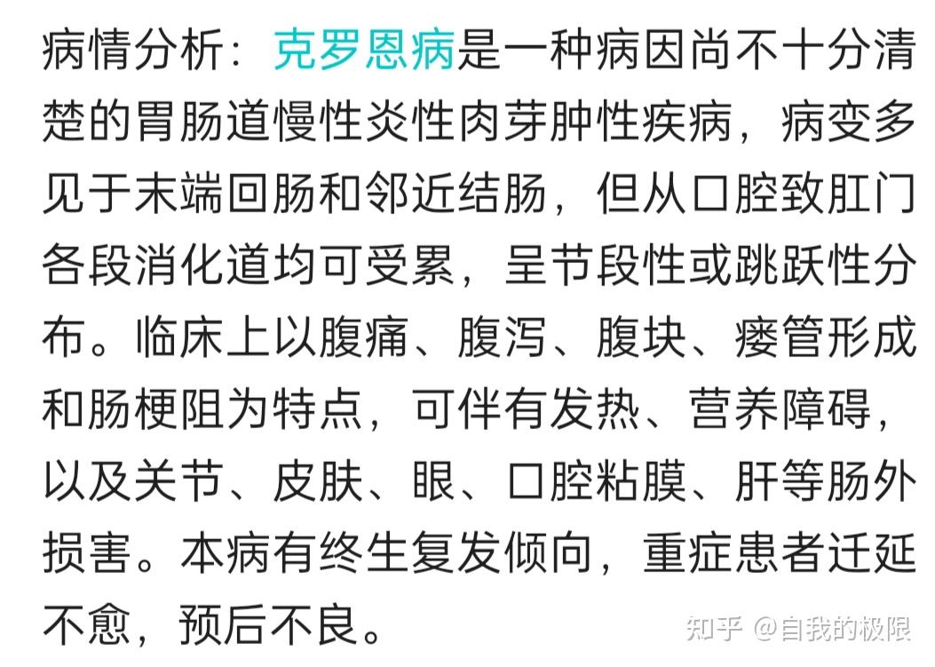 慢性直肠乙状结肠炎,回肠末端粘膜慢性炎属于慢性结肠炎吗? - 知乎