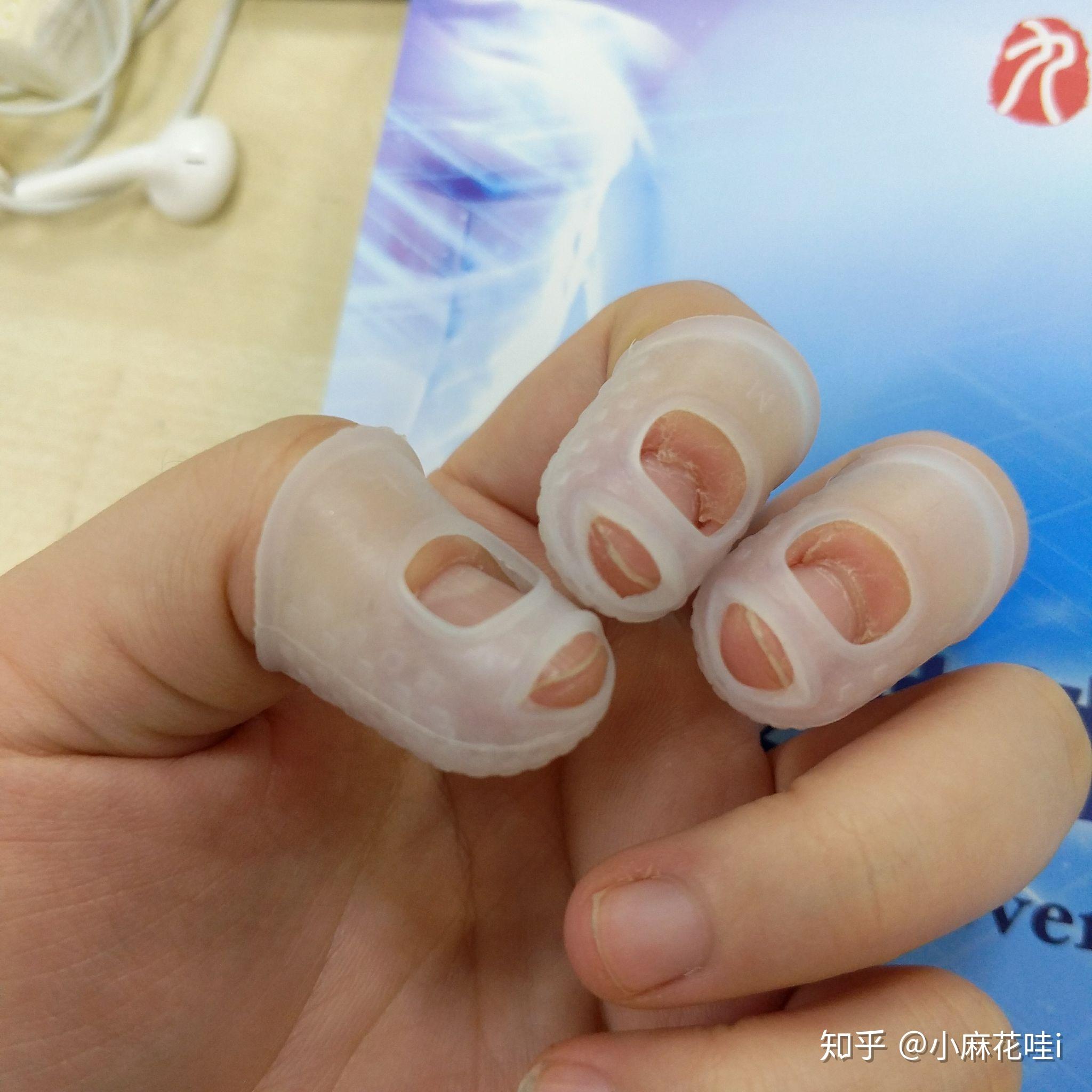 成年人如何改掉抠手的习惯?有什么心理学道理?