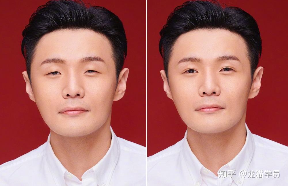 李荣浩的眼睛能整容变大吗? - 知乎