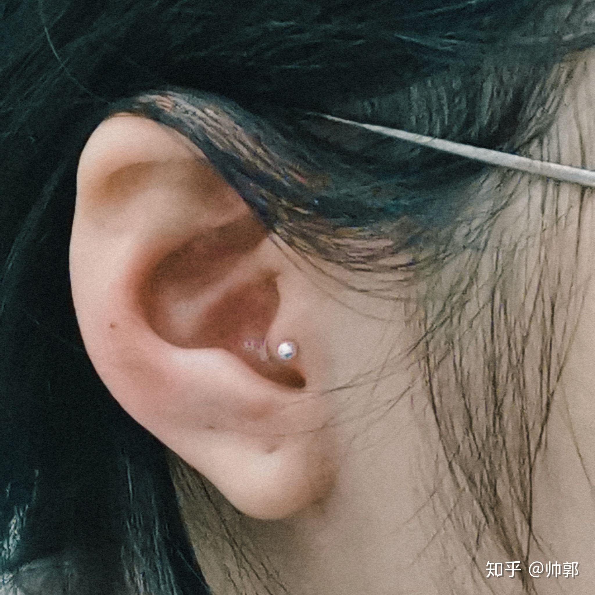 请问耳屏打耳洞会很疼吗?