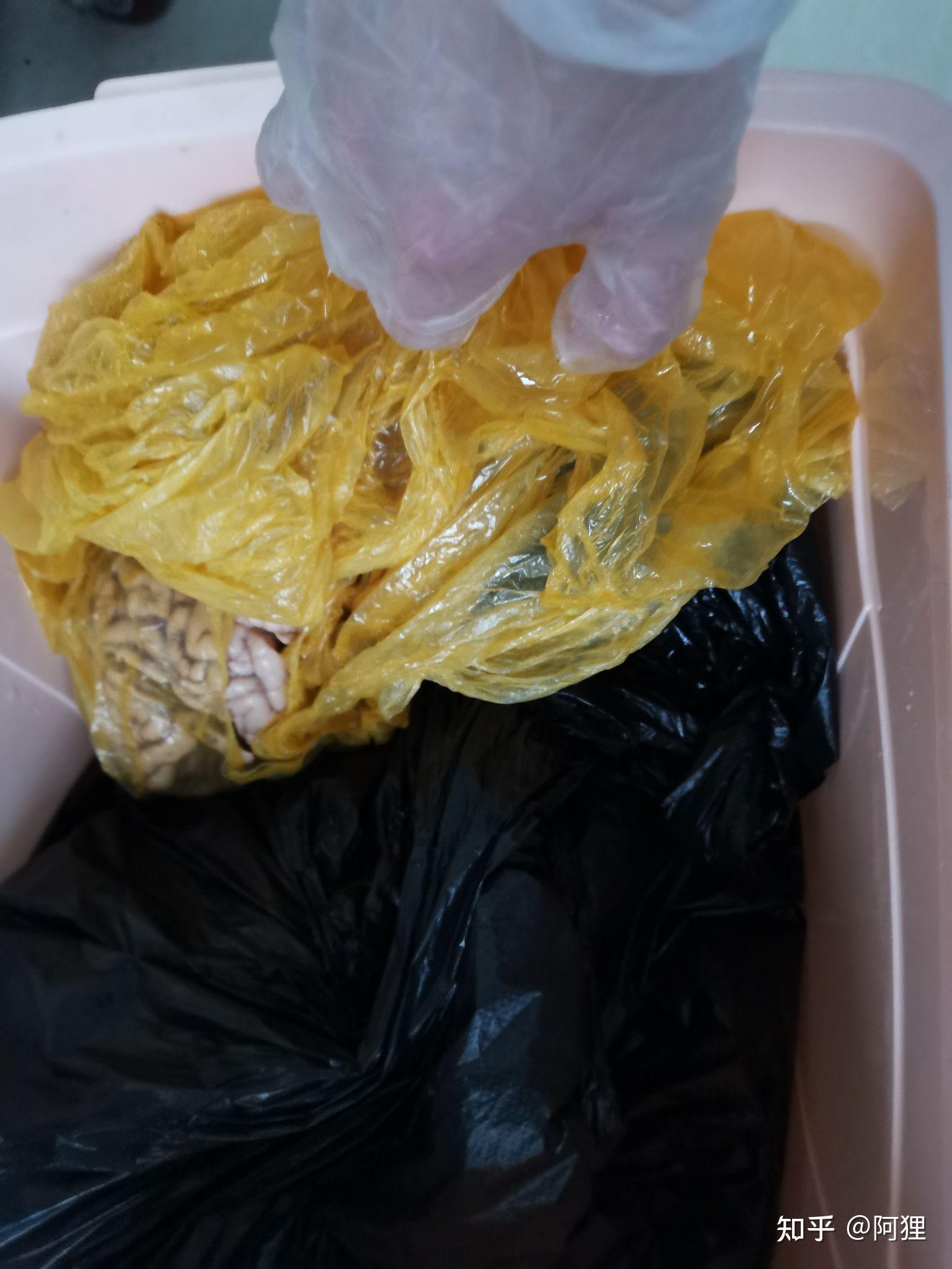 福尔马林保存尸体原理是什么啊? - 知乎