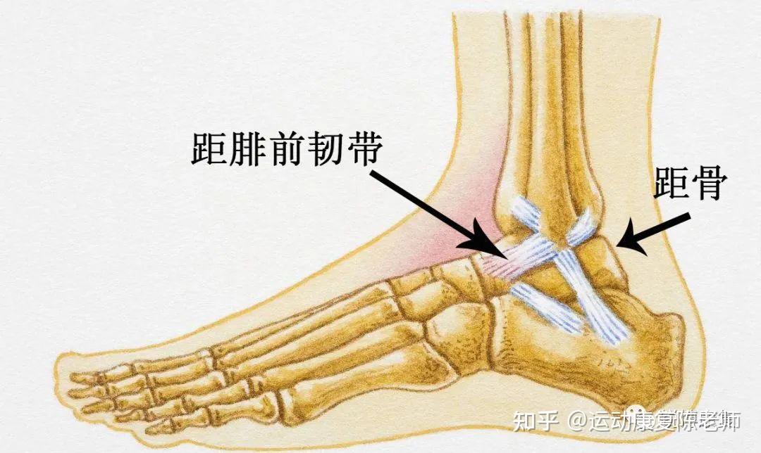 左踝距腓前韧带损伤怎么治疗? - 知乎