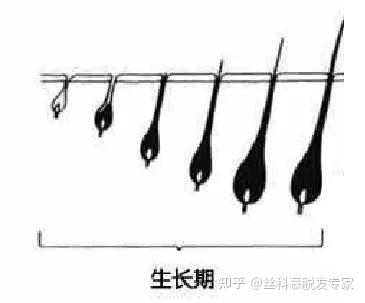 为什么不长头发