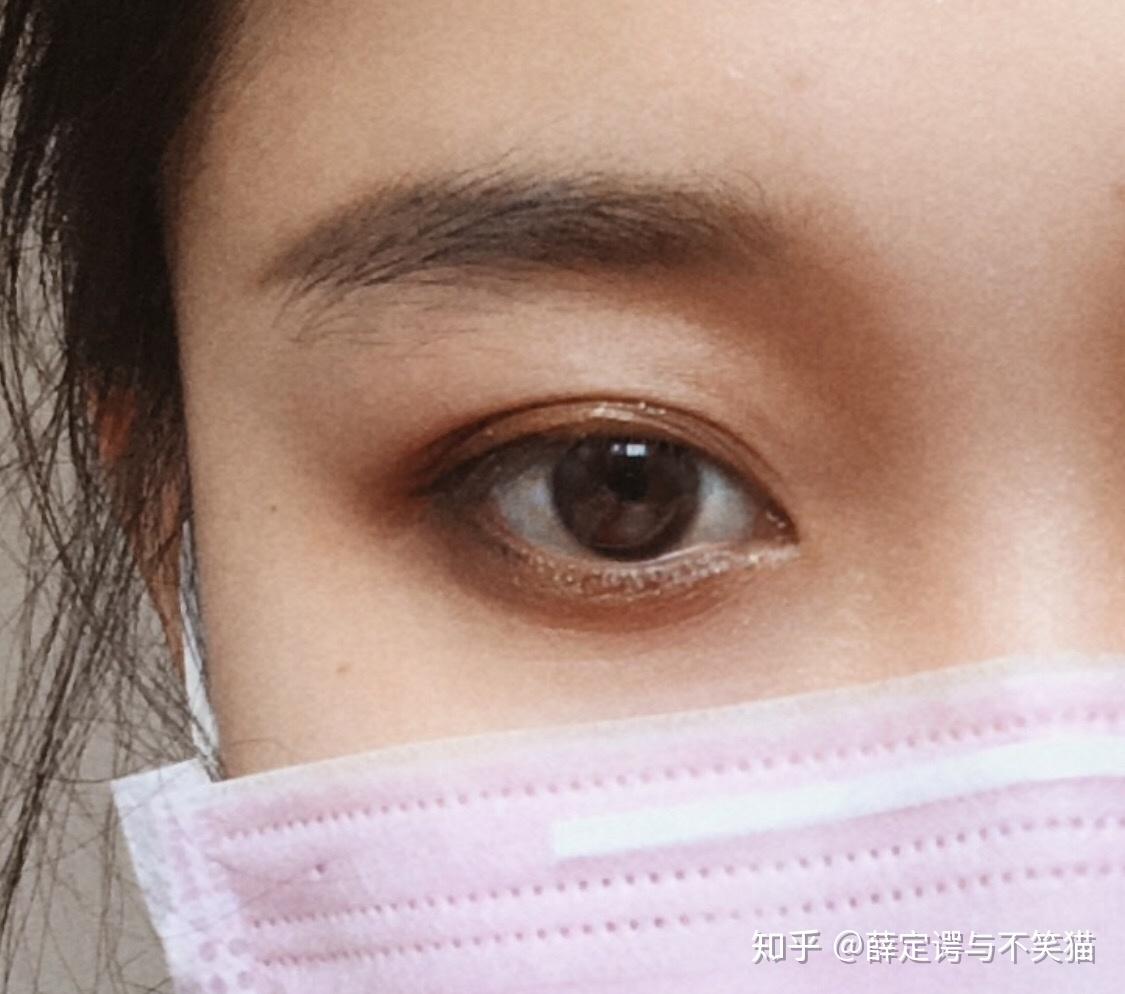 拥有三眼皮是一种什么感受?