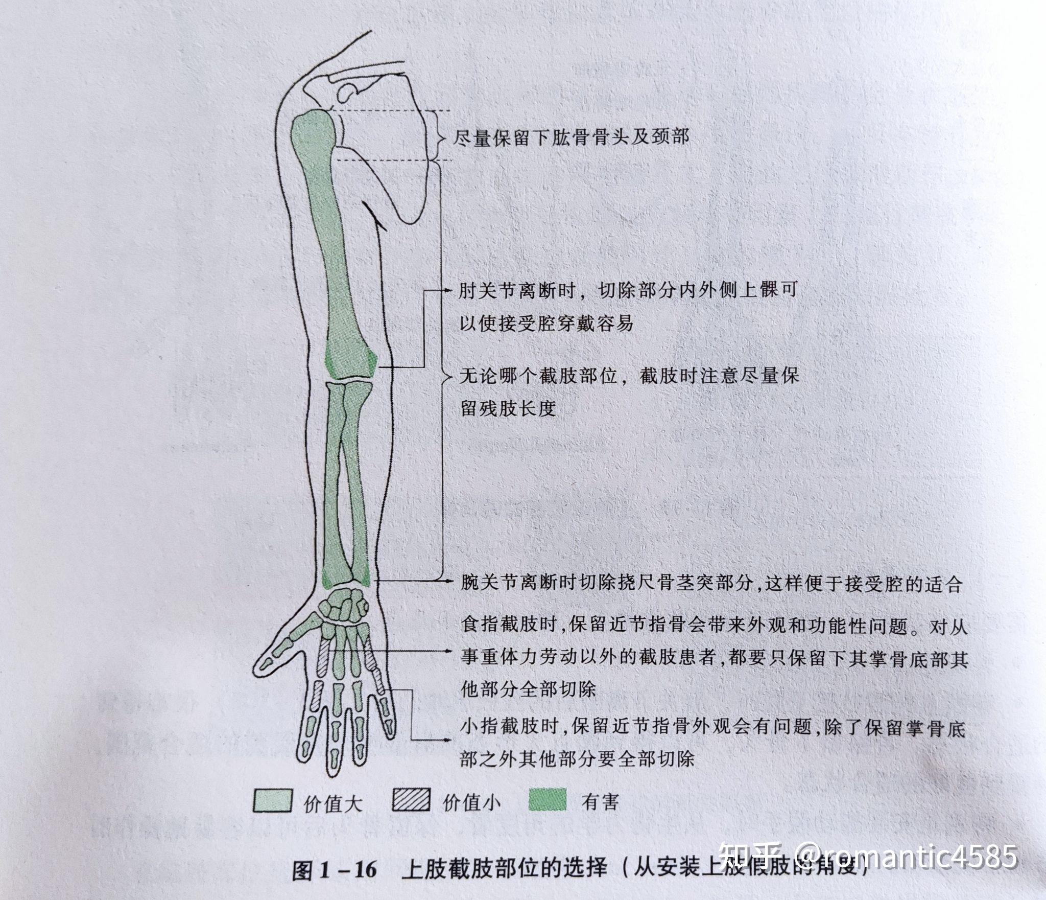当事人回应放炮炸伤男孩致截肢,该如何避免类似情况的发生? - 知乎