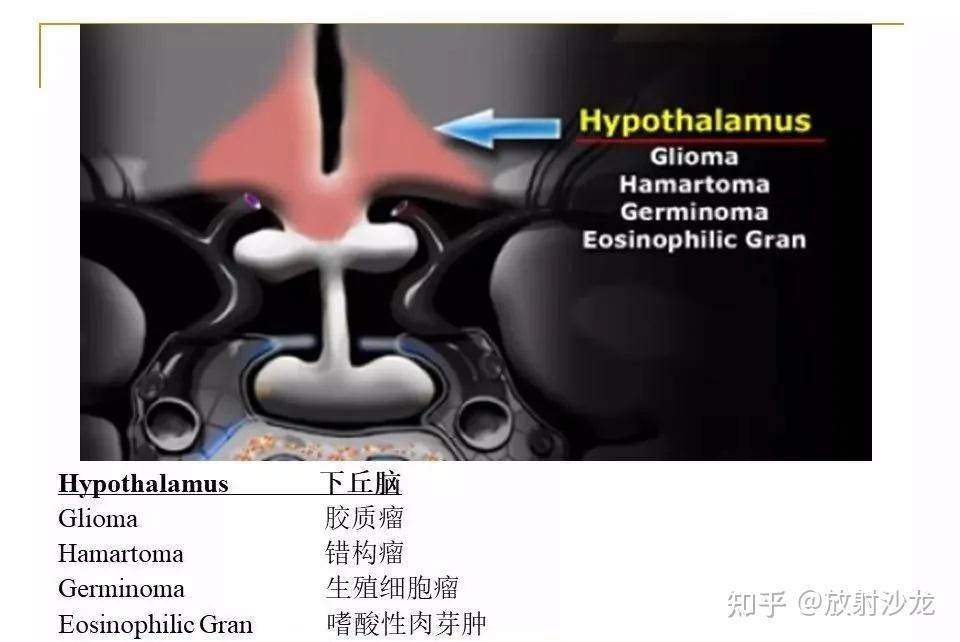 【收藏】蝶鞍及鞍旁区域解剖 - 知乎