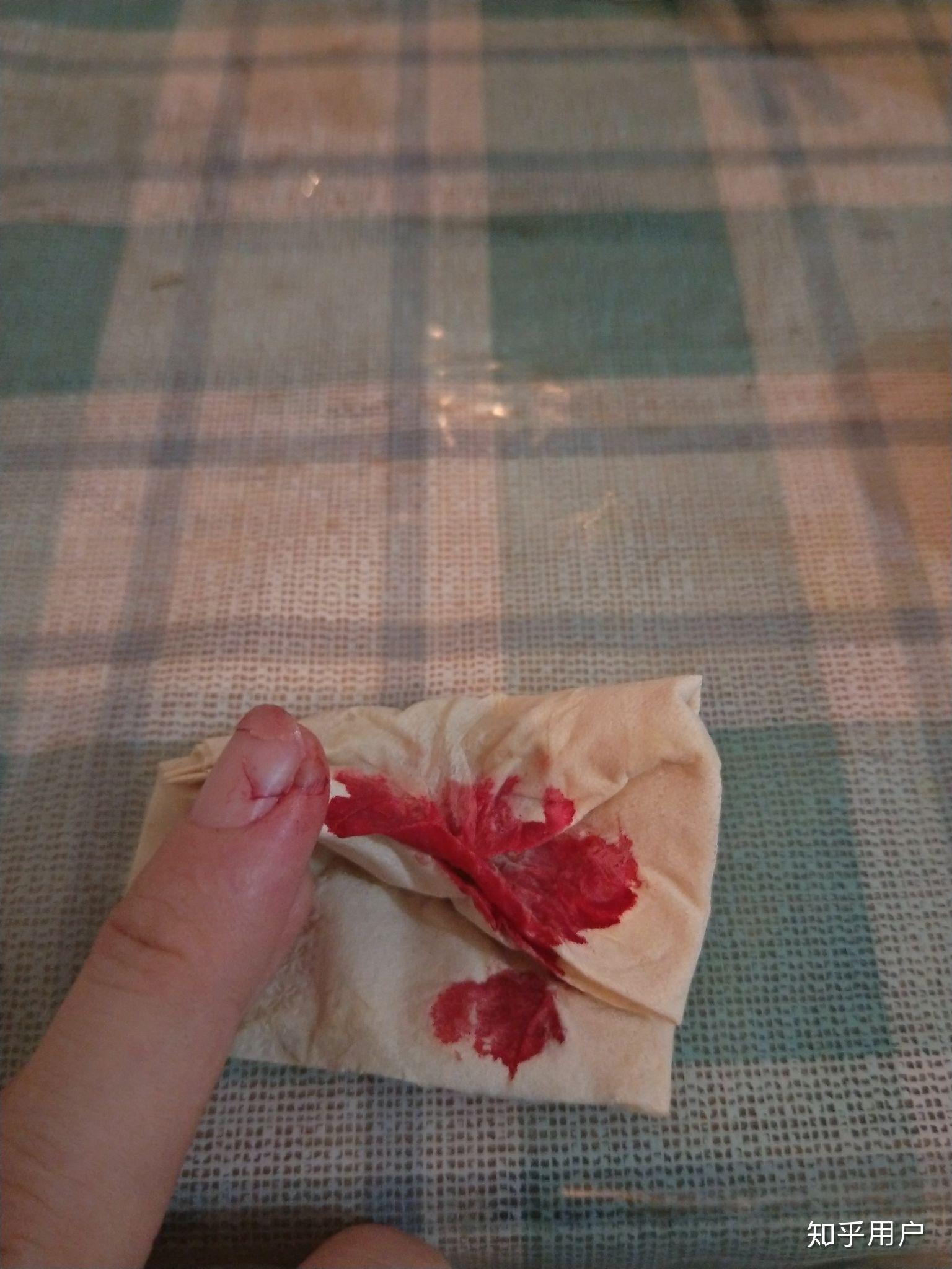 切菜时切到手是一种什么样的体验? - 知乎