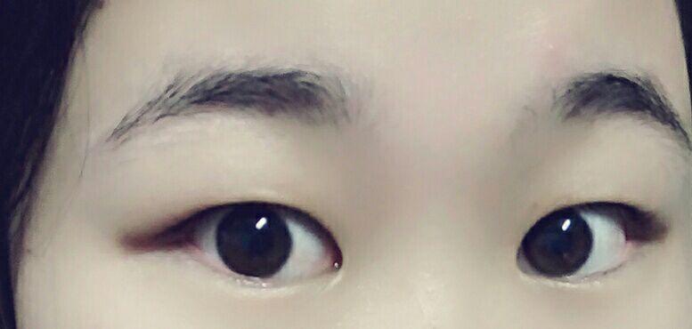 眼睛丑是怎样一种体验