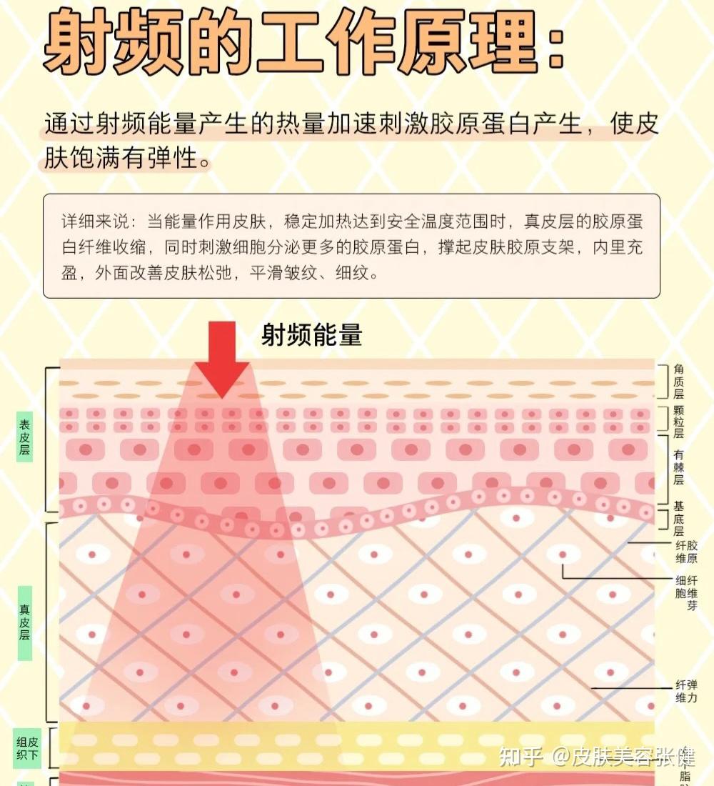 射频消融术的禁忌症有哪些