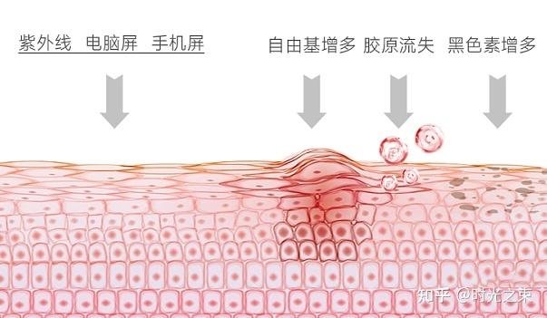 干纹、细纹、皱纹!!不同类型的问题你分清了吗? - 知乎