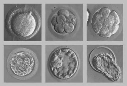 試管嬰兒囊胚移植成功率有多高為什麼醫生會建議養囊