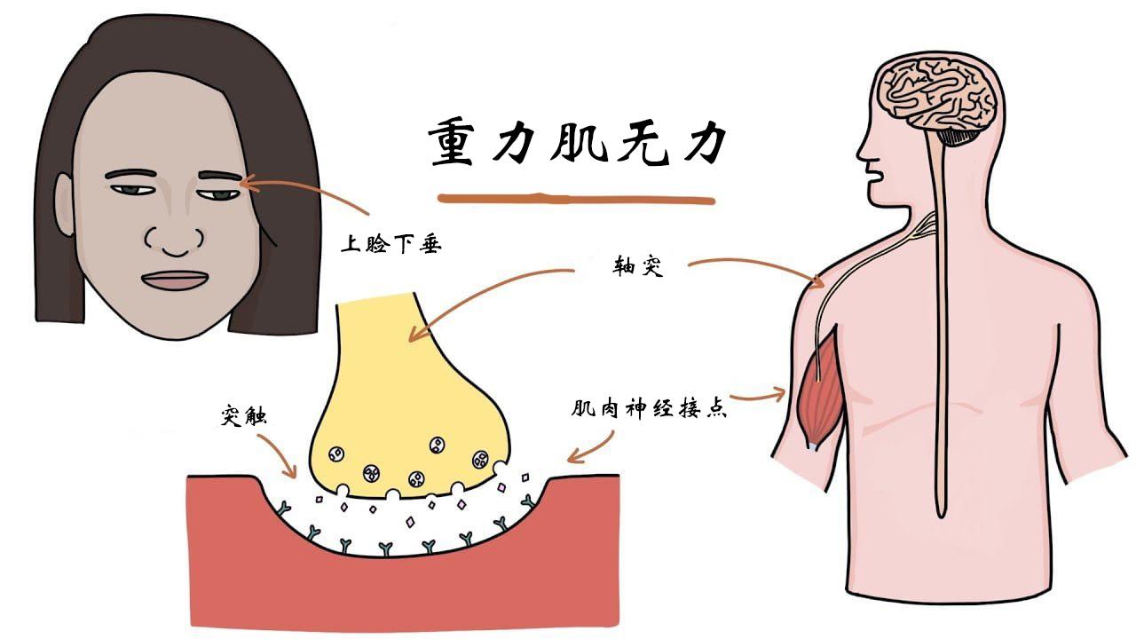 gmg怎么才能加入联盟