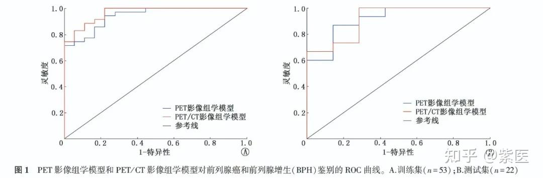 基于18F-PSMA-1007 PET/CT影像组学模型在前列腺癌与前列腺增生鉴别诊断中的价值 - 知乎
