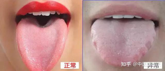 中医看舌头就能知道你有问题,怎么看的呢? - 知乎