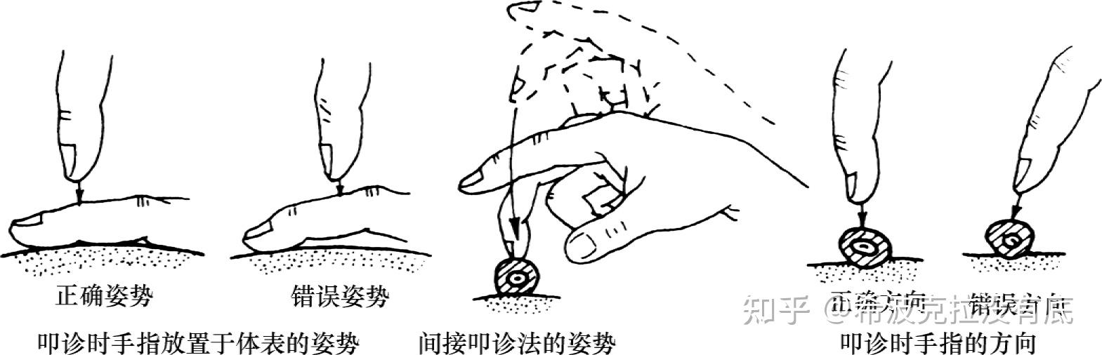 叩诊音有哪些 ?