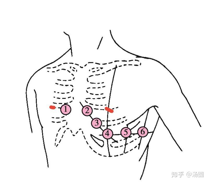 女生做心电图需要脱内衣吗? 