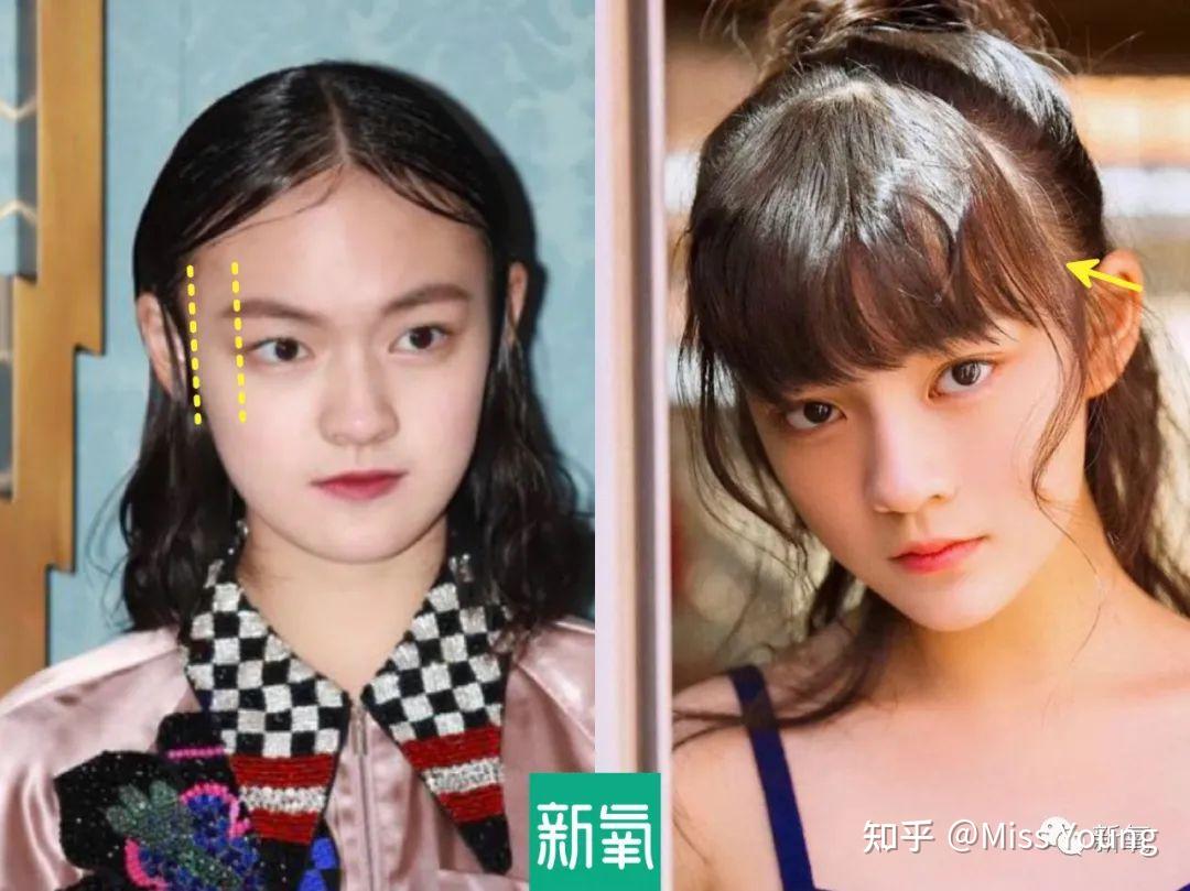 颅顶低真的很丑吗