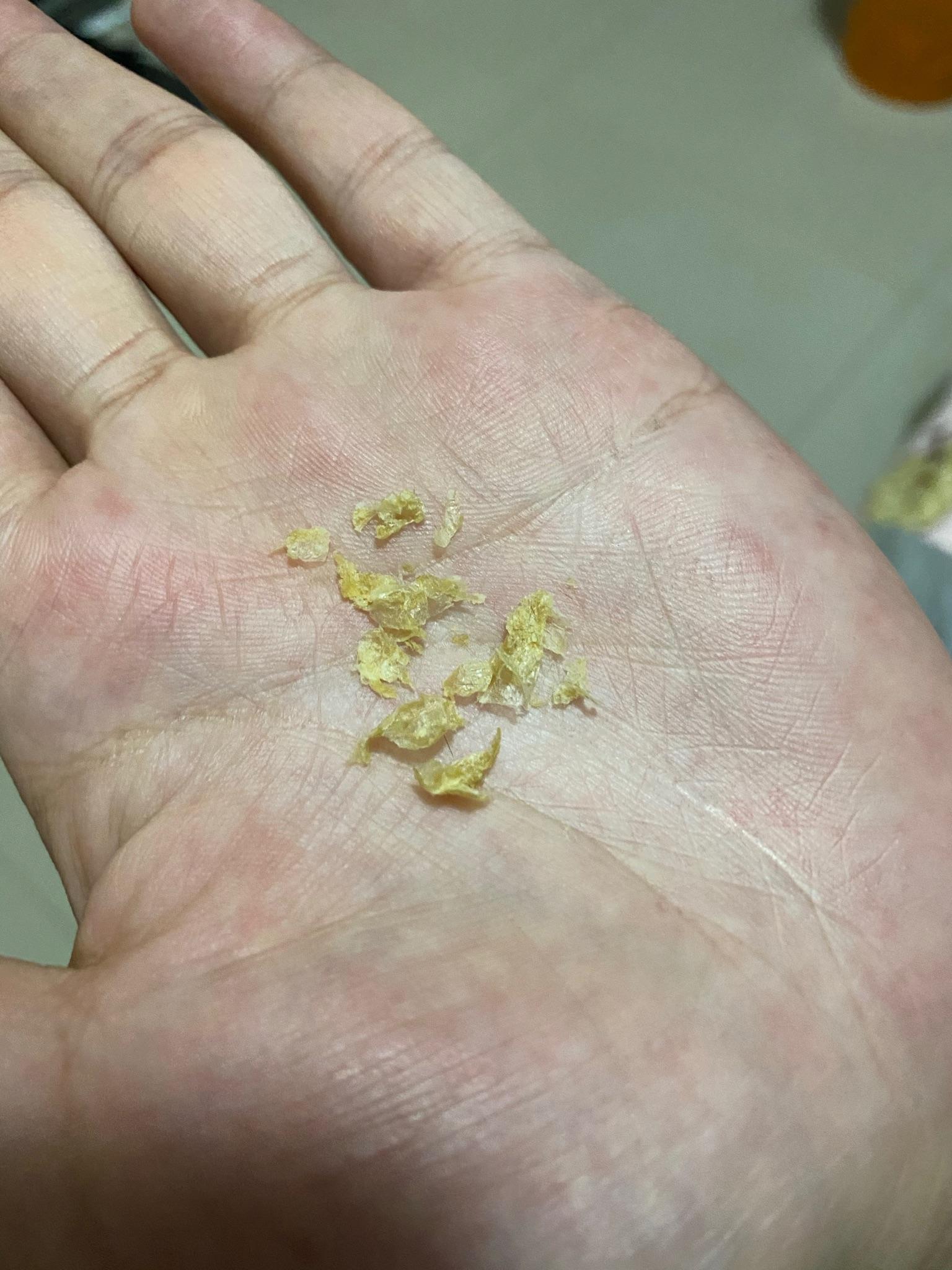 耳屎能大到什么程度? - 知乎