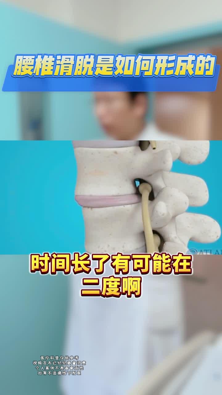 腰椎滑脱一二三四度图图片