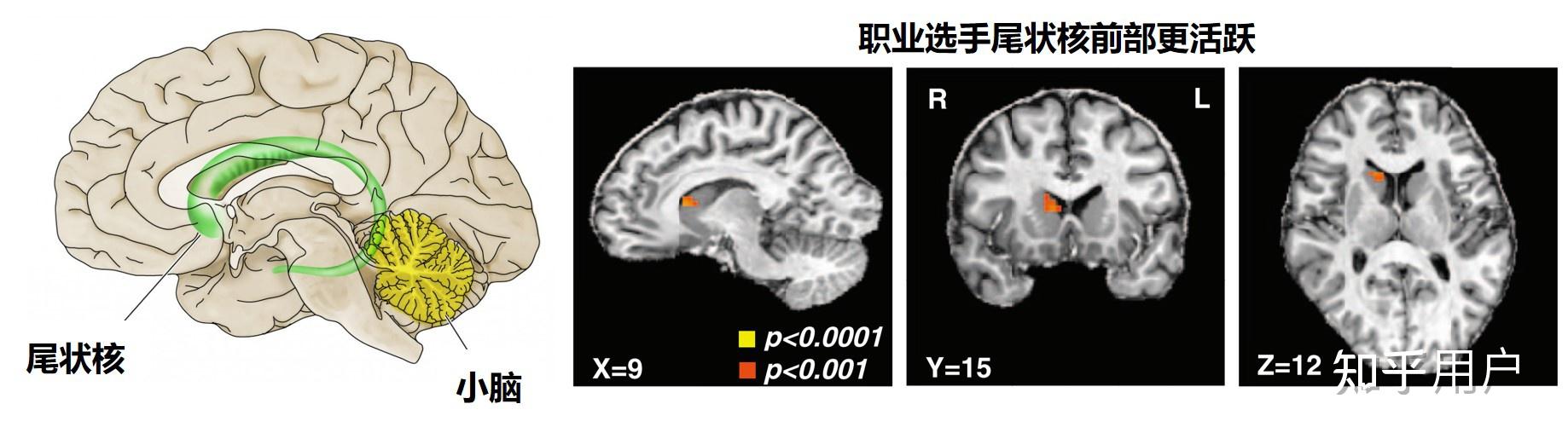 「直觉」本身,在大脑中,是如何产生的? - 知乎
