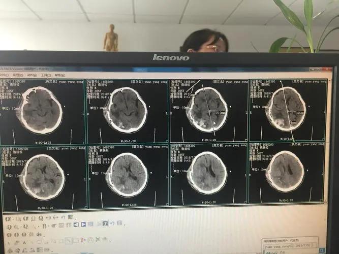 长沙神经症如何很好的识别:长沙和谐医院精神科 - 知乎